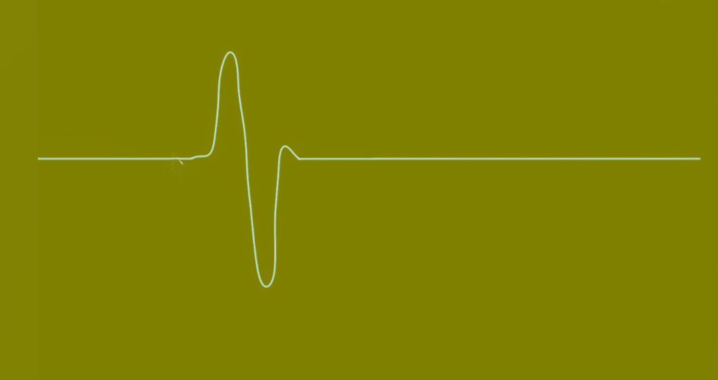 Localized particle